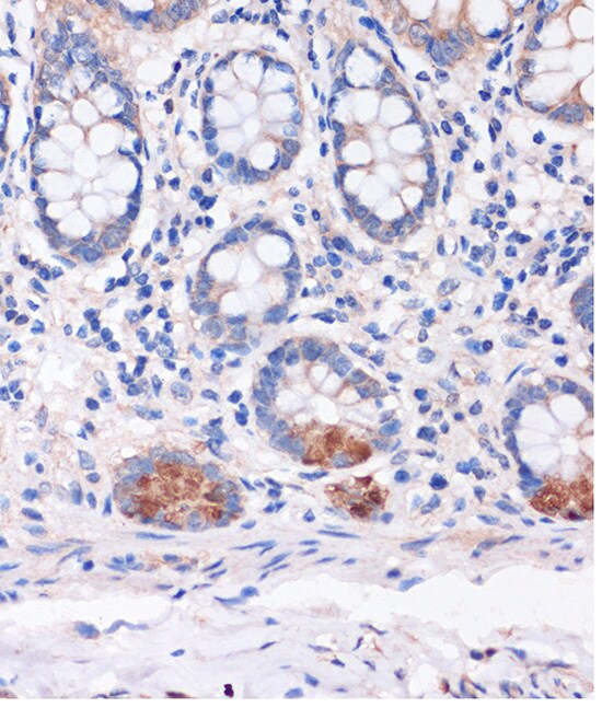 SMYD3 Antibody