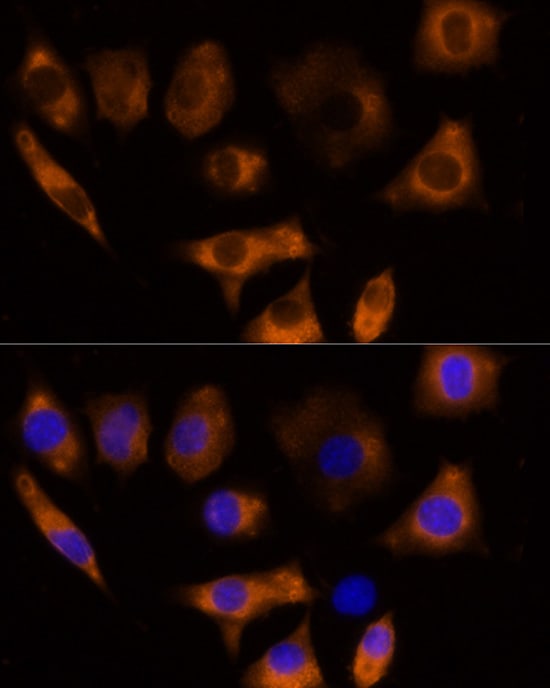 Calpain 3 Antibody