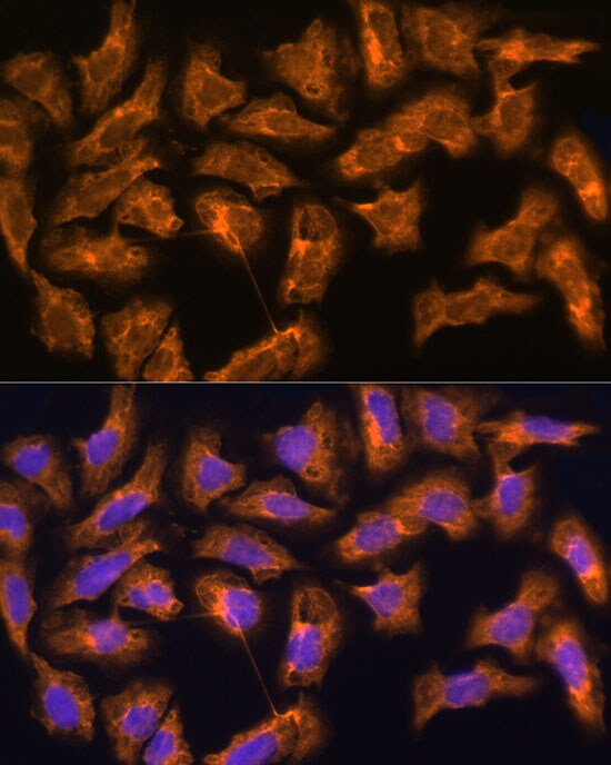 SPRR3 Antibody