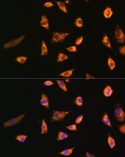SPRR3 Antibody