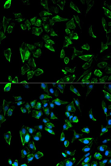 tropomyosin-3 Antibody