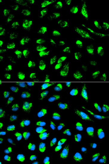 DCI Antibody