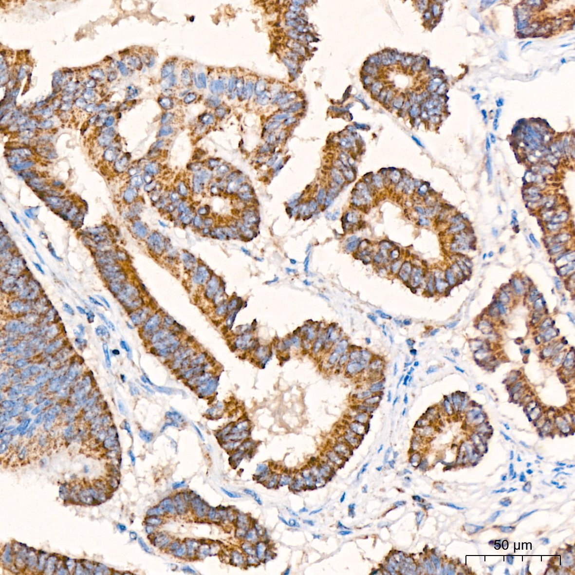 DCI Antibody