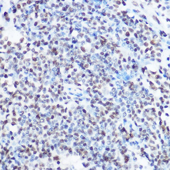 SART3 Antibody