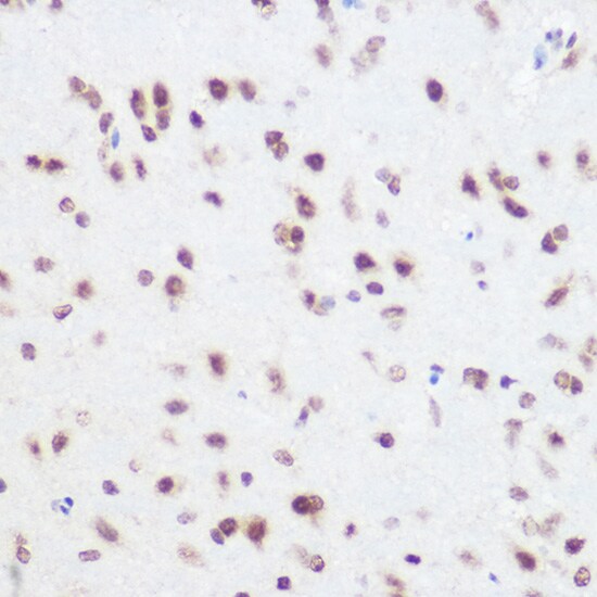 SART3 Antibody