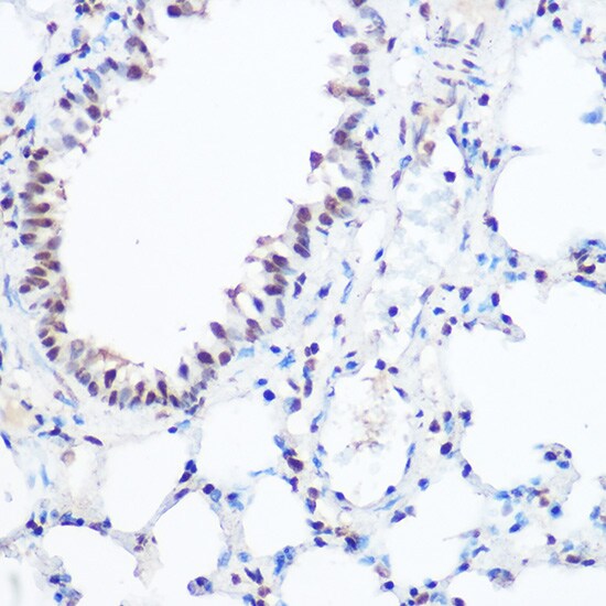 SART3 Antibody