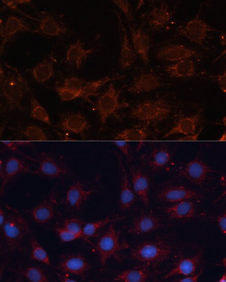 SLC25A24 Antibody