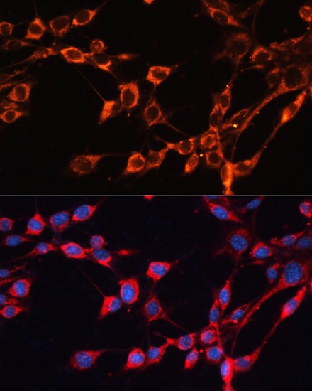 SLC25A24 Antibody