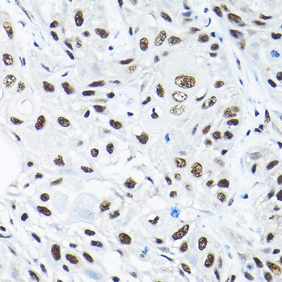 SNRPA1 Antibody