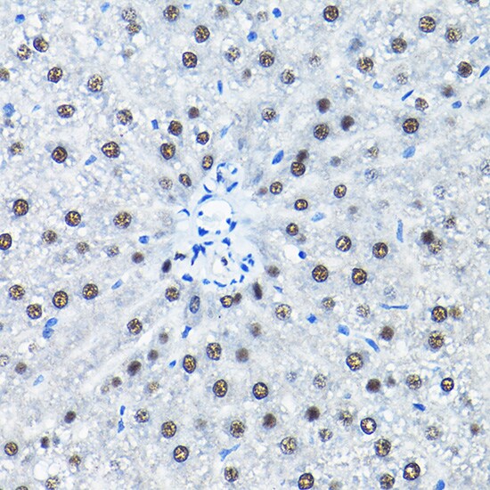 SNRPA1 Antibody