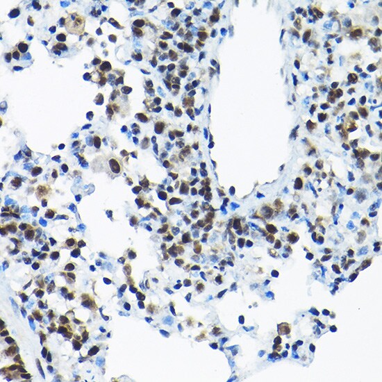 SNRPA1 Antibody