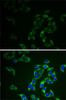 Adenylate Kinase 1 Antibody