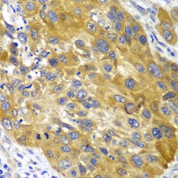 Adenylate Kinase 1 Antibody