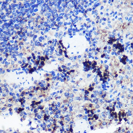 FCHSD1 Antibody