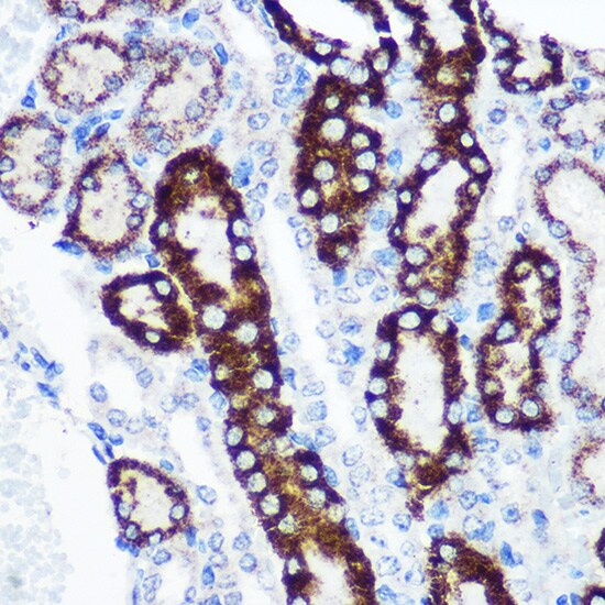 FCHSD1 Antibody