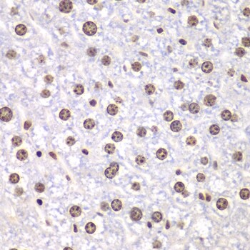 Topoisomerase I Antibody