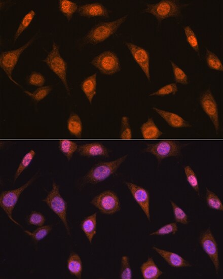 MAD2L2 Antibody