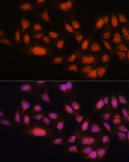 MAD2L2 Antibody