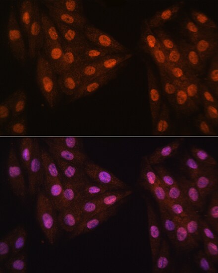 MAD2L2 Antibody