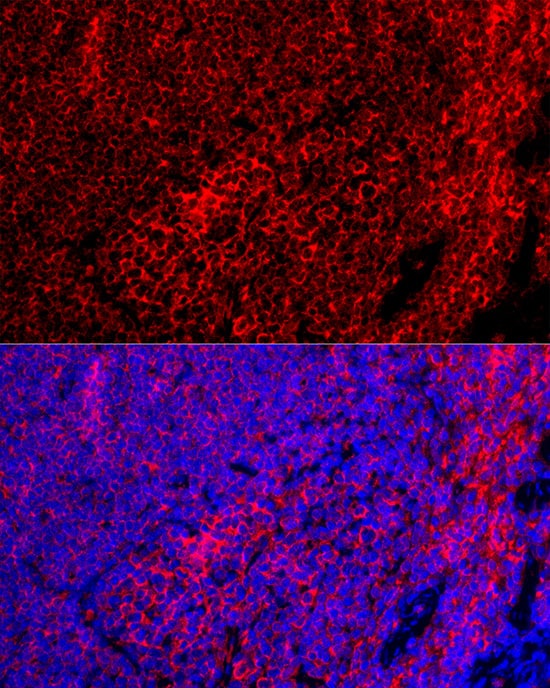 EMR1 Antibody