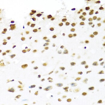 PRP19 Antibody