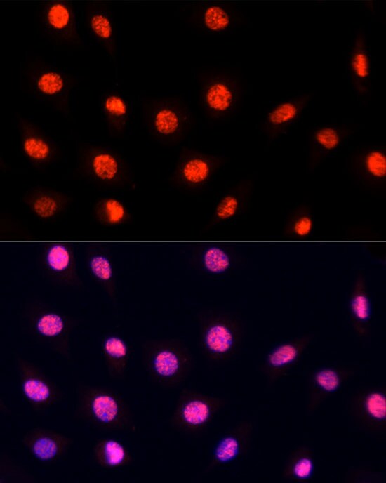 PRP19 Antibody