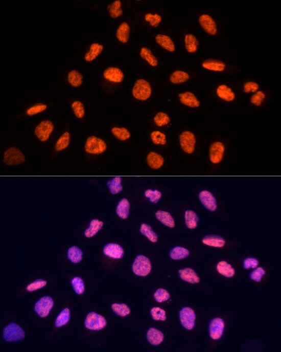 PRP19 Antibody