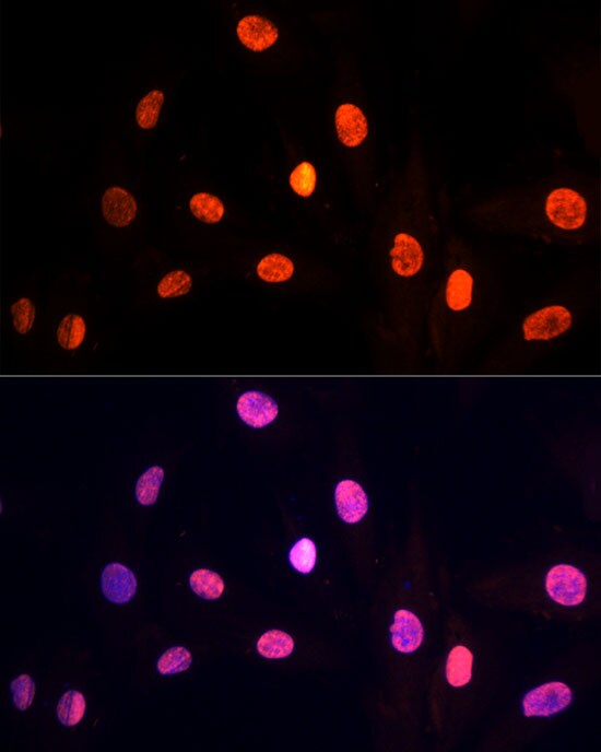 PRP19 Antibody