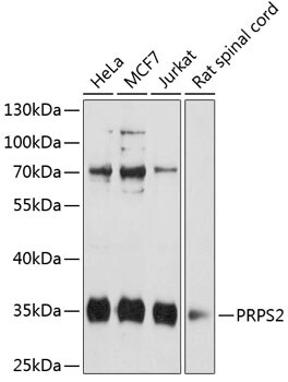 PRPS2 Antibody
