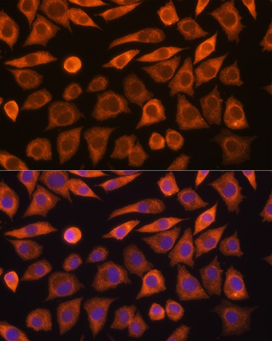 Guanylyl Cyclase alpha 1 Antibody