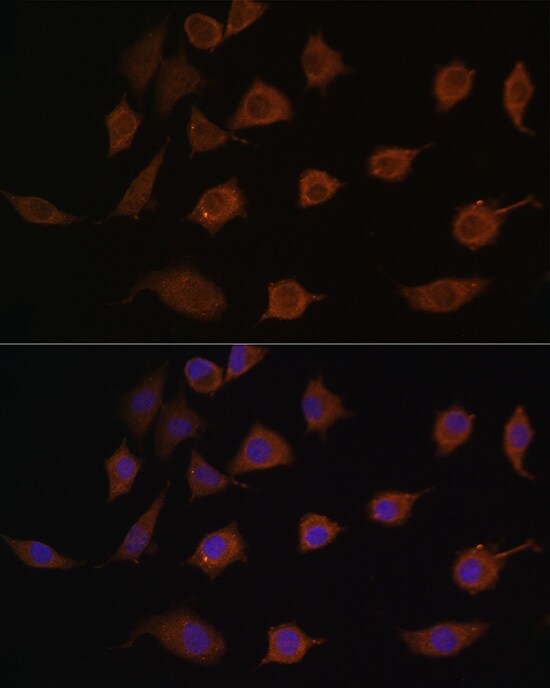 LSM1 Antibody