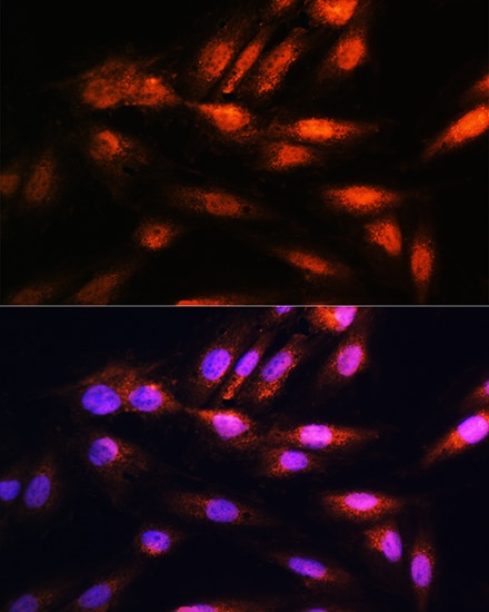 COPS8 Antibody