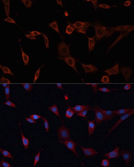 PDIA2 Antibody