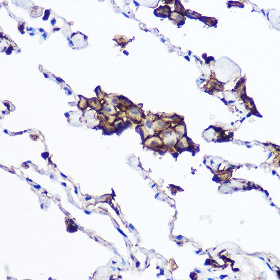 HLA DPB1 Antibody