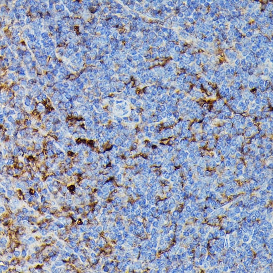 HLA DPB1 Antibody