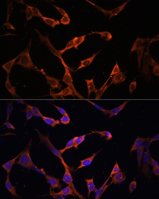 HLA DPB1 Antibody