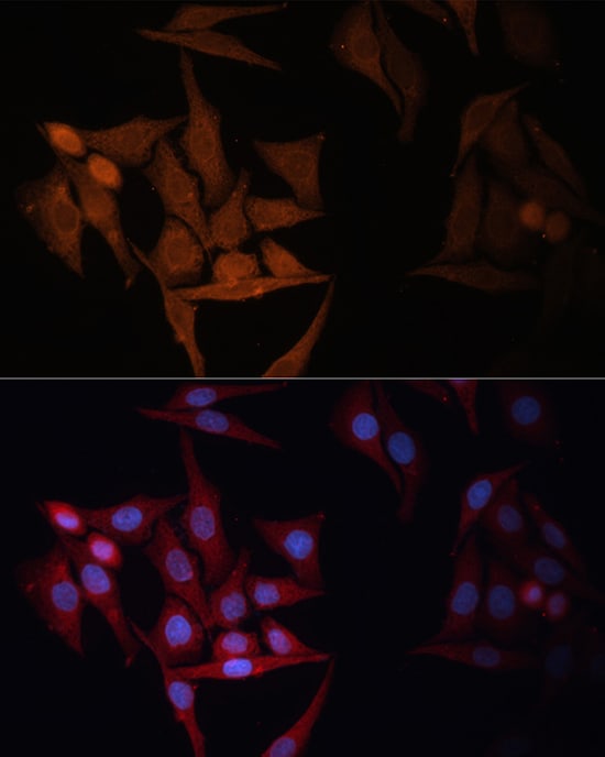 HLA DPB1 Antibody