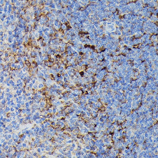 HLA DPB1 Antibody