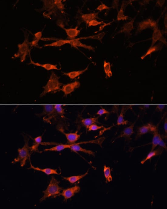 HLA DPB1 Antibody