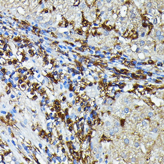 HLA DPB1 Antibody