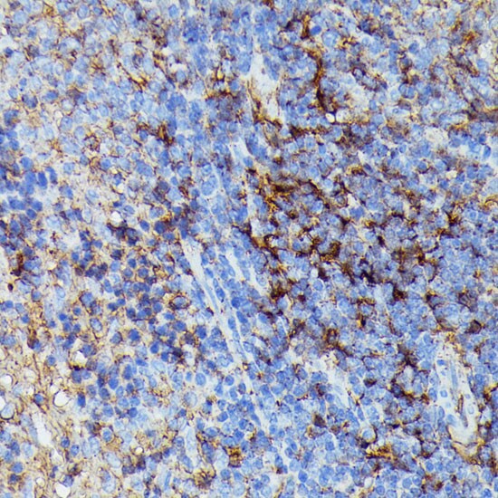 HLA B Antibody