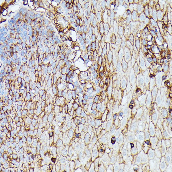 HLA B Antibody