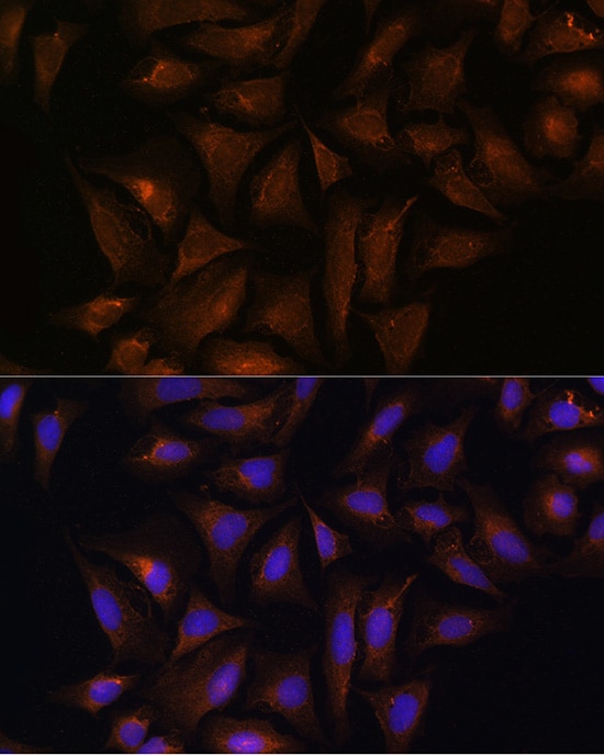 CRYZ Antibody