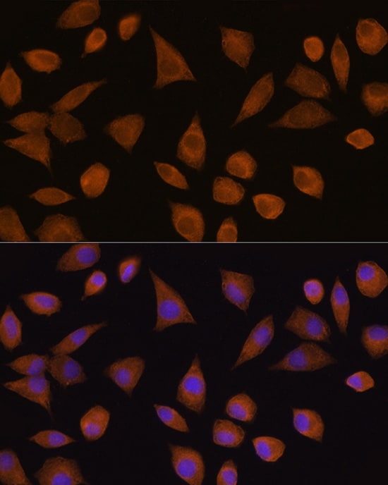 CRYZ Antibody