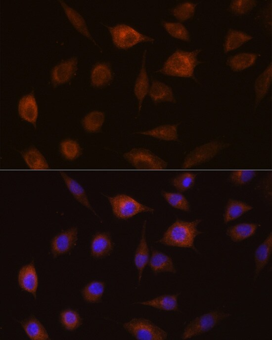 GSTT1 Antibody