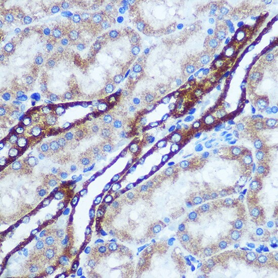 GSTT1 Antibody