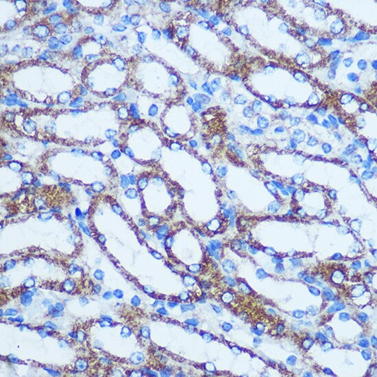 GSTT1 Antibody