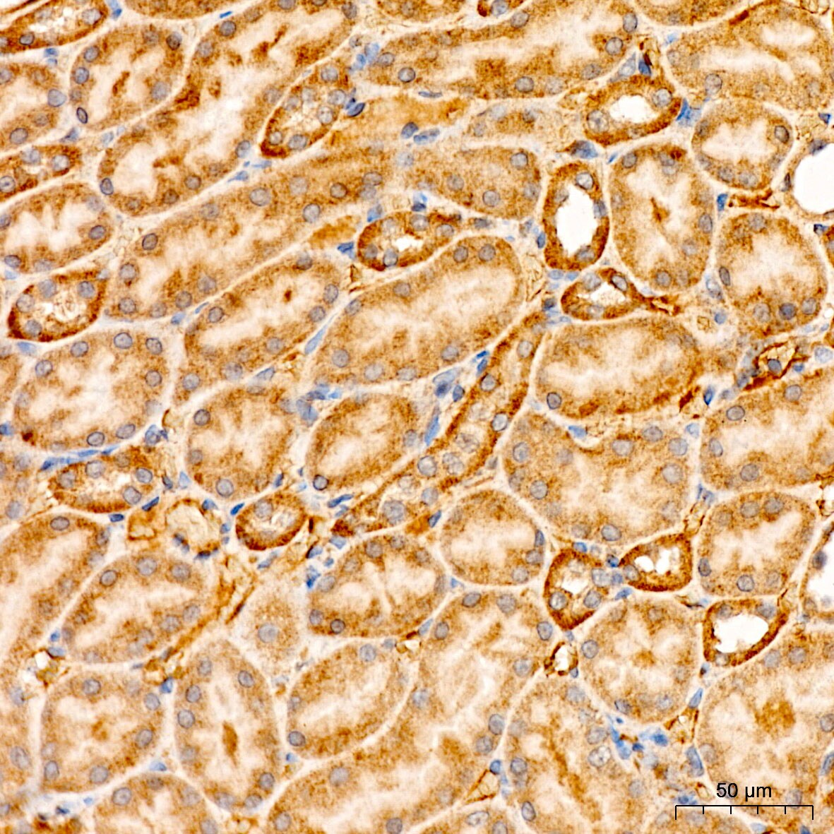 XRCC6BP1 Antibody