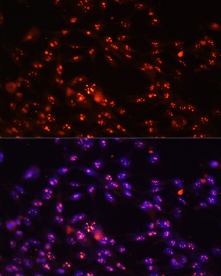 DKC1 Antibody