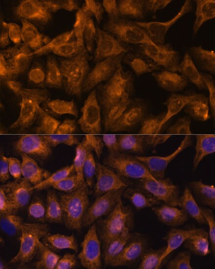 Septin-5 Antibody